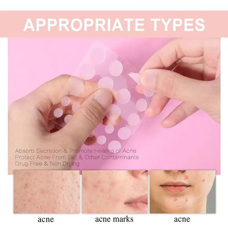 Adesivo Removedor de Acne